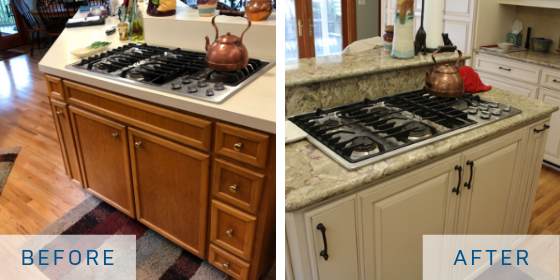 refacing before after